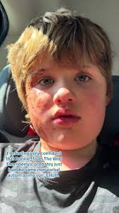 Adeem Tran Elliot Berry