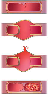 European Society for Vascular Surgery (ESVS) 2025 Clinical Practice  Guidelines on the Management of Vascular Trauma