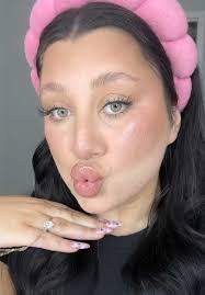 Lip Filler Experience: The Struggles and Joys