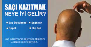 Saci Kazitmak Neye Iyi Gelir Op Dr Atilla Kaya