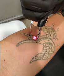 Best tattoo removal in new york. 2 Day Laser Tattoo Removal Training Course Minnesota Brow Lash Studio Academy