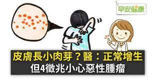 好發年紀一般為30歲之後 隨著年齡增加而遞增 特別常見於更年期後女性以及肥胖者 皮膚肉芽 皮膚贅疣是皮膚的良性增生 不具有傳染性 但是有增多的可能 出現原因通常是因為皮膚老化或是體質關係 也有一說認為是皮膚遭受紫外線傷害所造成