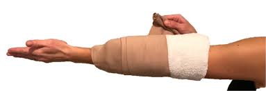 Cubital Tunnel Syndrome Raleigh Hand Surgery Joseph J Schreiber Md