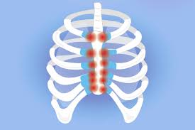 Pain in the ruq that may spread to the shoulder and lower back. Costochondritis And Arthritis Understanding Symptoms And Treatment