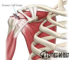 Rotator Cuff Sendromu Tedavisi Fitnessandbeast