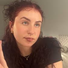 Stefan's getting some movement in his right hand !! 🙂