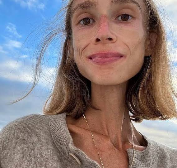 Woman dies in Bali hotel room following extreme all fruit diet | Irish Star