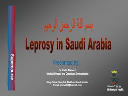:) i hope this has helped you!!! Ppt Ø¨Ø³Ù… Ø§Ù„Ù„Ø© Ø§Ù„Ø±Ø­Ù…Ù† Ø§Ù„Ø±Ø­ÙŠÙ… Leprosy In Saudi Arabia Powerpoint Presentation Id 510711