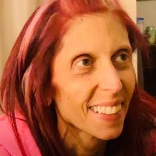 Rachael gives her recovery update after her IVC filter removal. It's been a  rocky road lately that we are hoping to smooth out. Thank you for all of  the love and ongoing