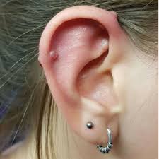 Piercing narbe/ loch entfernen lassen, cheek piercings. Trend Agent Anti Wildfleisch Piercing Disc 5er Pack Hilft Gegen Wildfleisch Keloid Granulation Fur Piericngs Von 1 0 Bis 2 0 Mm Starke Amazon De Schmuck