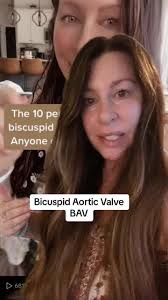 Has anyone have BAV and had the valve replaced and would like to share...