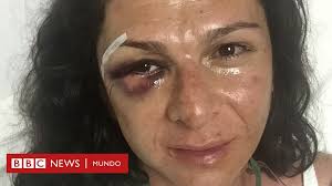 En su declaración patrimonial como titular de la conade, dice que su máximo nivel de estudios es secundaria. Lo Que Revela La Golpiza A La Medallista Olimpica Ana Gabriela Guevara Del Problema De Violencia Contra La Mujer En Mexico Bbc News Mundo