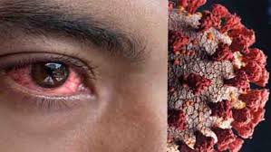 According to the us centre for diseases control and prevention (cdc), mucormycosis or black fungus infection is caused by a group of molds called. Maharashtra Man Who Recovered From Covid 19 Dies Of Mucormycosis Or Black Fungus Infection Oneindia News