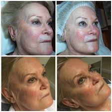 Schoonheidssalon Rosalie