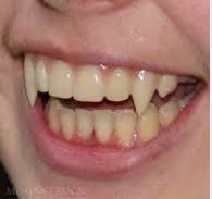 We did not find results for: Vampire Teeth For Real Posts Facebook