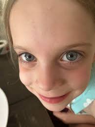 Daughter's eye color change from blue