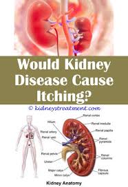 Kidney Disease Quotes Kidney Disease Polycystic Kidney Disease Chronic Kidney Disease