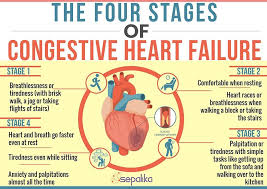 Pin By Morgana On Heart Failure Heart Failure Symptoms