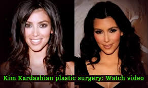 Kimberly noel kardashian west (born october 21, 1980) is an american media personality, socialite, model, businesswoman, producer, and actress. Kim Kardashian Before And After Plastic Surgery Watch Video India Com