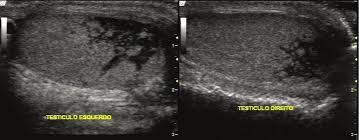 ULTRASSONOGRAFIA GERAL (Teórica e Teórico-Prática)