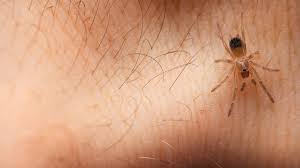 Image result for wolf spider bite skin