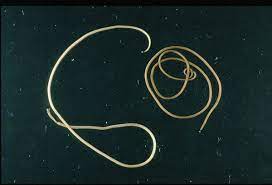 Whether you're sending gifts from the uk to nigeria for a birthday, or you've sold an item on ebay and need shipping to nigeria, we can help. Parasitic Horsehair Worms Facts Life Cycle And Effects Owlcation