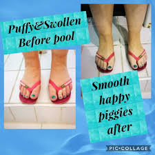 If you are flying over long distances, it can be very uncomfortable and it can also cause many problems to your legs, feet and ankles. Trouble With Swollen Feet Ankles Aqua4mums