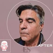 Dr Eli Shulman • aesthetic & beauty