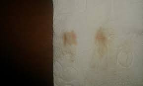 Sangrado De Implantacion Primeros Sintomas Babycenter