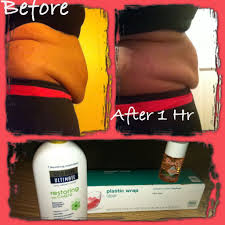 Pin On Bio Oil Diy