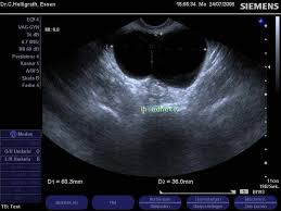 Und die mechanische behandlung von erkrankungen des uterus und seiner adnexe. Praxis Dr Helligrath Ultraschall Galerie