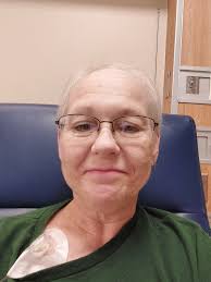 Is it normal for zebras' temps to jump to 100 degrees?