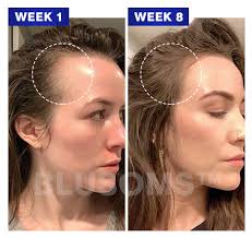 Blusoms HairGrowth Formula Serum Sprey