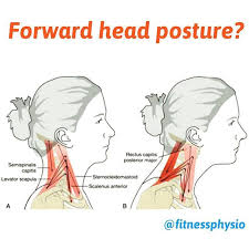 Pin On Acupuncture Acupressure Trigger Point Therapy