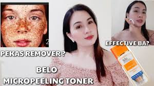 Laser treatments starting from $9. Pekas Remover Belo Micropeeling Toner Youtube