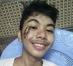 Check spelling or type a new query. Viral Selfie Dengan Kecoak Awas Terserang Alergi Dan Asma Gaya Tempo Co