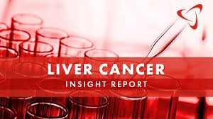 About the size of a football, it's located mainly in the upper right portion of your abdomen, beneath the diaphragm and above your stomach. Liver Cancer Insight Report Current Therapies Drug Pipeline And Outlook