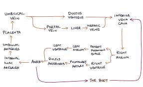 Image result for Delayed Transition from Fetal Circulation