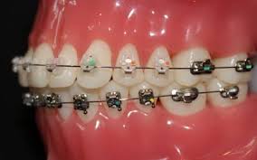 Klinik pakar pergigian subang is a klinik gigi based in subang jaya, selangor. Klinik Gigi Subang Bestari Dentist3 Dental Clinics Dentists Klinik Gigi ç‰™åŒ» In Malaysia