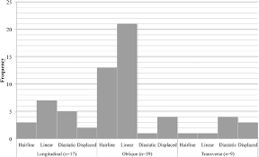 Clival Fractures In A Level I Trauma Center In Journal Of