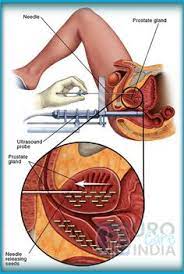 The pancreas is an organ that releases enzymes involved with digestion, and hormones to regular blood sugar levels. 8 Reproductive System Male Ideas Reproductive System Men Health Tips Mens Health