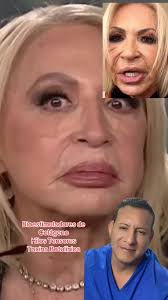 Secretos de Belleza de Laura Bozzo: Rejuvenecimiento Estético