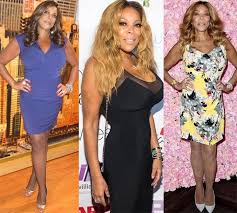 Pin On Wendy Williams Plastic Surgery