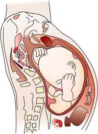 Image result for Compound Presentation