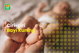 Ciri ciri penyakit liver yang kedua adalah perubahan warna kulit menjadi lebih kuning. Bayi Kuning Pada Bayi Penyebab Dan Cara Mengatasinya K24klik