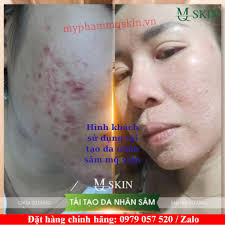 Serum Tái Tạo Da Nhân Sâm Mq skin