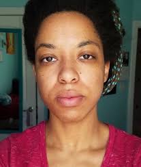 Trusting the Earth to Clear Your Skin — Candace Howze