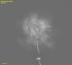 Image result for Raphidiocystis