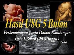 Terkadang kurangnya informasi dapat mengarah pada hasil yang tidak terduga. Bayi 5 Bulan Dalam Kandungan Hasil Usg 5 Bulan 20 Minggu Youtube
