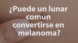 Hablamos del melanoma, un tipo de cáncer de piel que le costó la vida a 7.101 personas en 2020, según datos de la asociación española contra el cáncer.si bien es cierto que, según el organismo, la mortalidad ha bajado significativamente durante las décadas, la prevalencia en nuestro país no es cosa menor: Signos Y Sintomas Del Cancer De Piel Tipo Melanoma Youtube